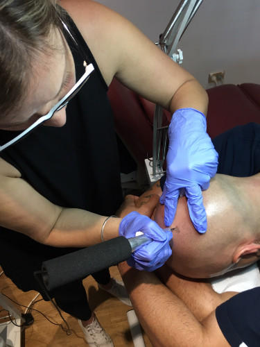 Best Tattoo Removal Treatments in Christchurch Central City, Christchurch |  Fresha